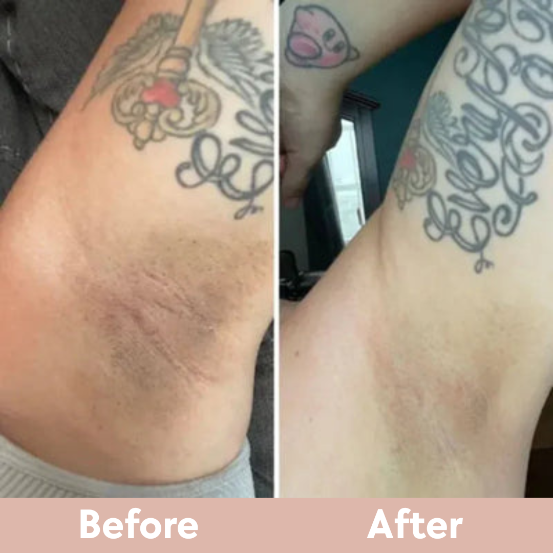 Kojic Acid & Turmeric Exfoliating Spray