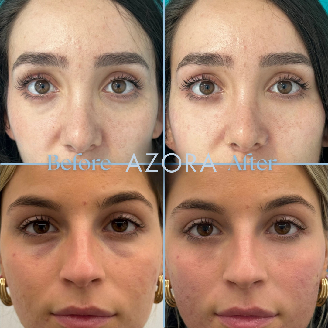 Aqua Bomb Eye Gel