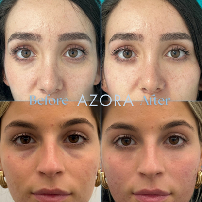 Aqua Bomb Eye Gel