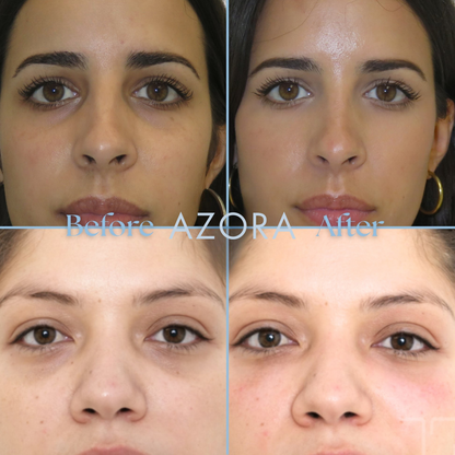 Aqua Bomb Eye Gel